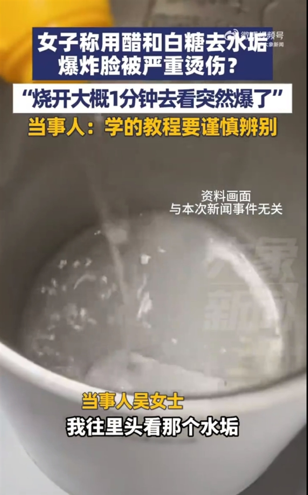 女子用醋加白糖去水垢致爆炸烫伤 当事人:烧开大概1分钟爆了 学的网上教程