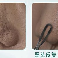 收缩毛孔去黑头粉刺！2025最新全能深层清洁产品权威实测热门款