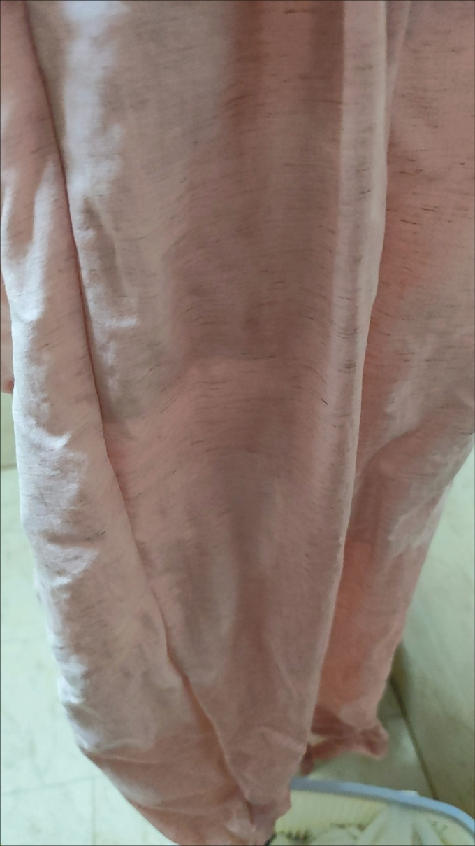 女裤