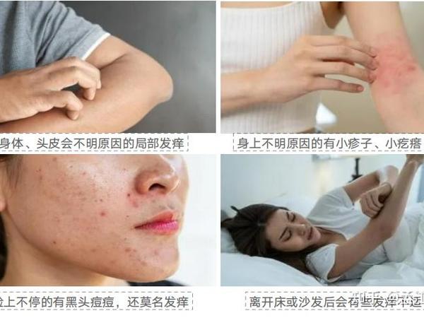 【全网硬核测评】2025热门除螨仪推荐！除螨仪到底是不是智商税？四大热门除螨仪终极PK！全部实测，拒绝云测评；友望、小米、莱克、九阳，谁才是“螨虫克星”？