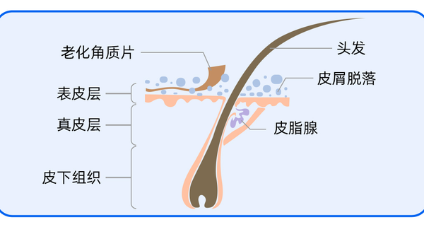 一个简单的方法，能有效抑制头皮屑！