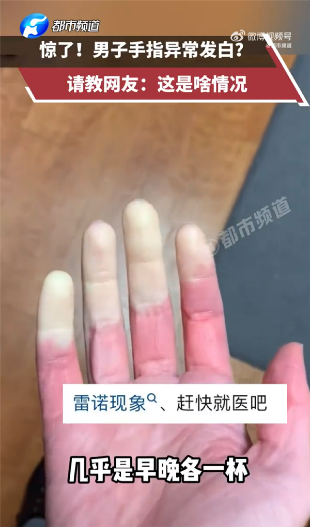 男子早晚一杯奶茶手指突变惨白 在线请教网友:这是啥情况