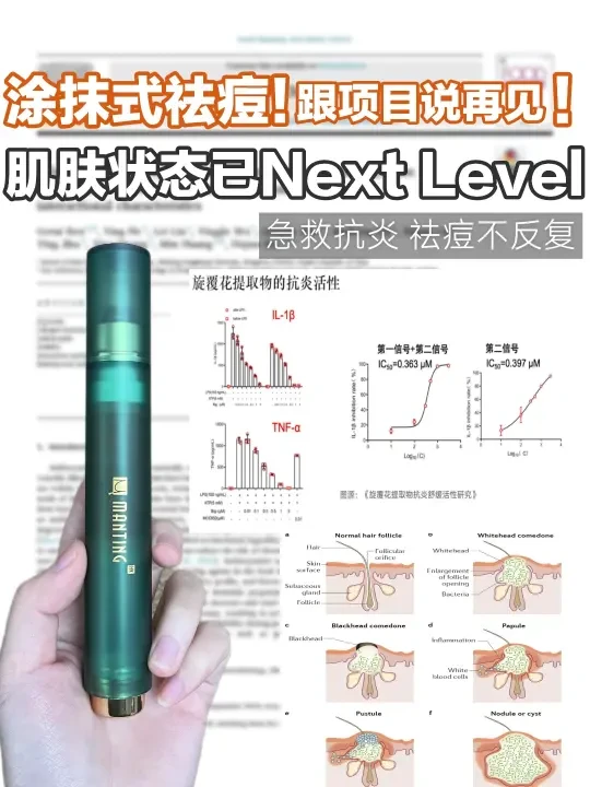满婷能把祛痘做成这，也是独一份！