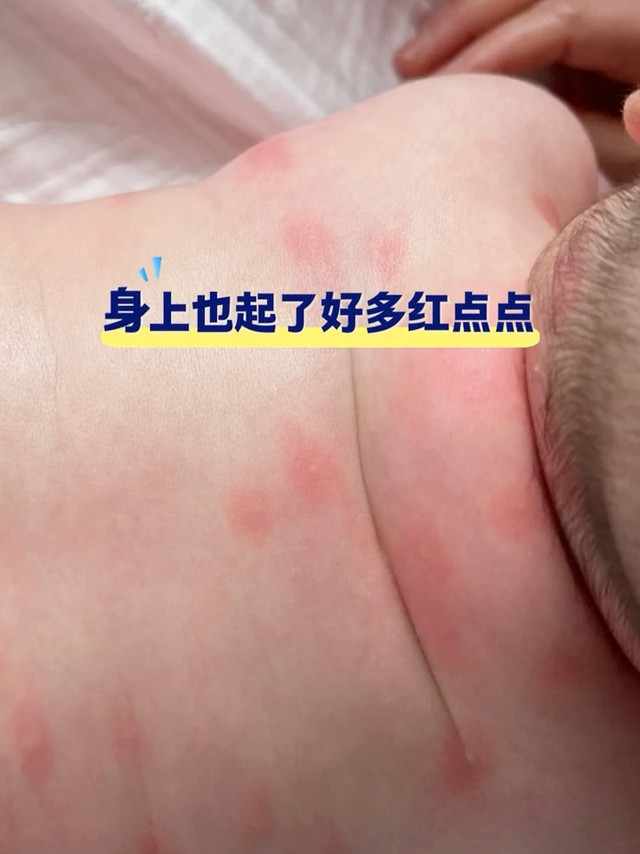 牛奶蛋白敏敏宝怎么选奶？二胎妈分享