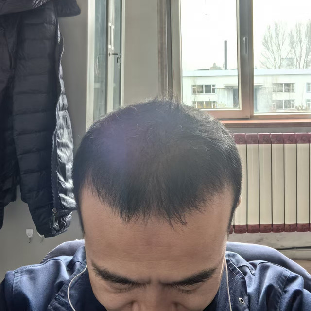 用实际效果证明这才是最好的！