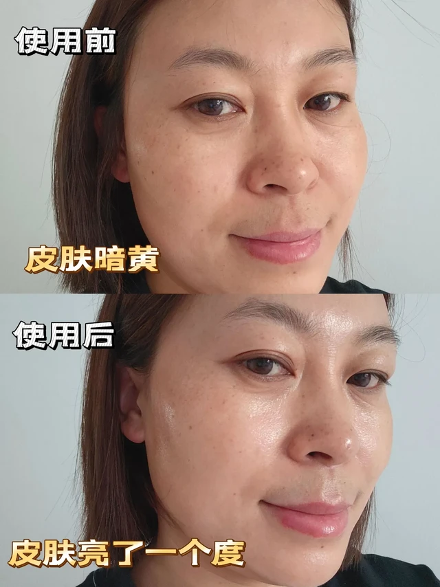 敏敏肌好物分享。敏敏肌再也不用被皮肤的红，黄，暗沉困扰了，我终于发现了一款清爽护肤搭配卓沿色修星光水+色修精华，含98%高浓度色修酵母，根源修敏三维焕亮#卓沿色修星光水 #卓沿色修精华 #卓沿色修面霜