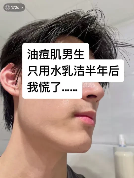油痘肌男生只用水乳洁半年后我慌了……