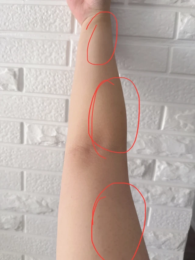 做一晚木工凌晨胳膊疼醒了