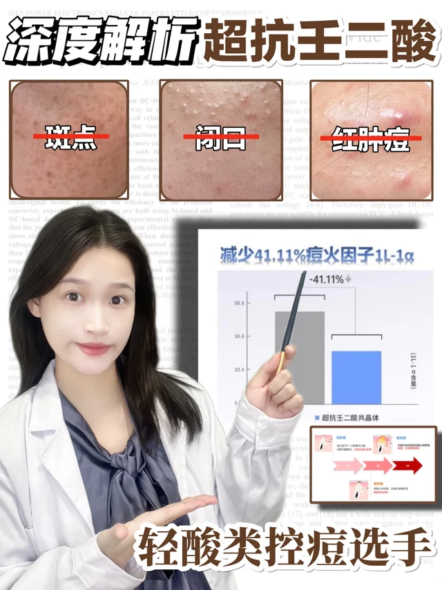 深度解析控痘届学霸-壬二酸