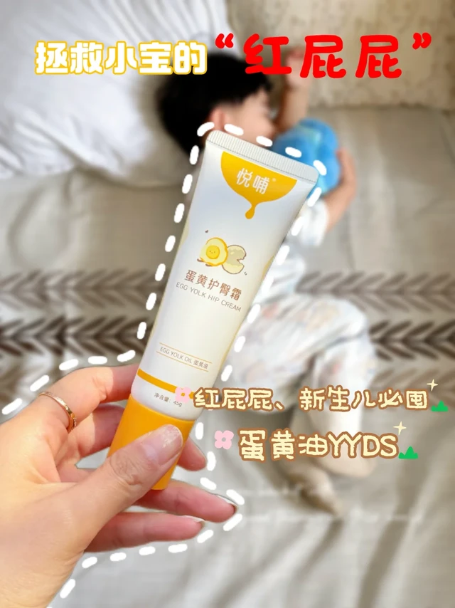 新手妈狂喜！精简护臀膏把红屁屁焊死在摇篮