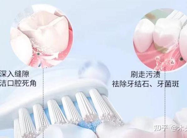 我们需要牵动牙刷么？