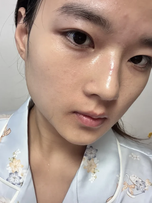 光子嫩肤过来人，真心劝你别乱做