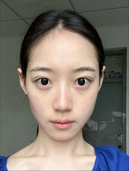 完蛋！大排灯照俩月给我照成这样了……..