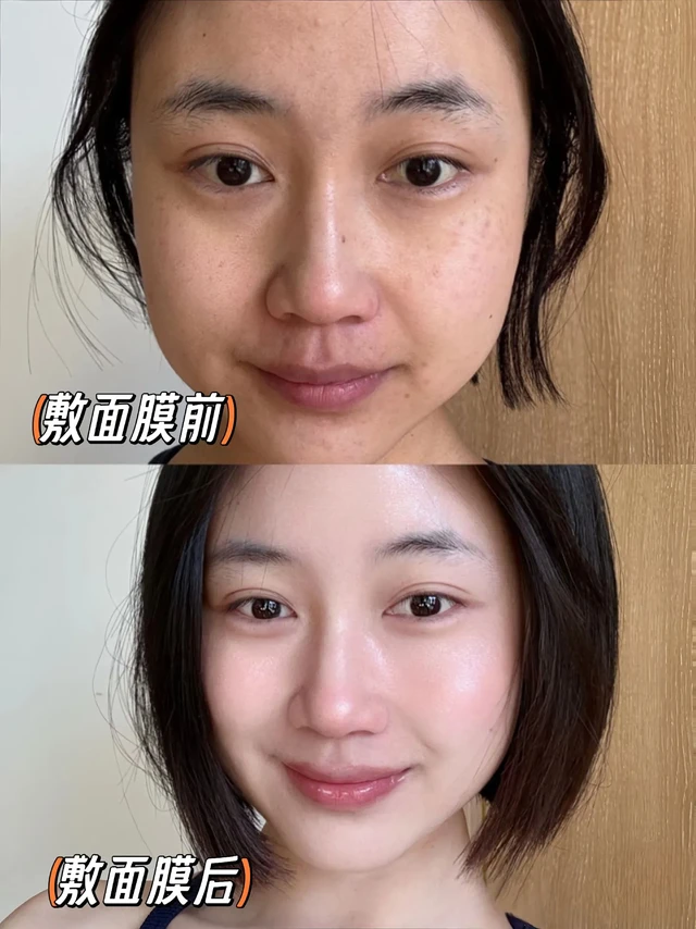 孕期没化妆却总被夸“皮肤好亮”？悄悄说，全靠妈咪专家孕妇面膜在撑腰呀～
 
满满精华深透补水，像给肌肤喝饱了水，那种自带柔光的通透感根本藏不住～ 从孕期到哺乳期都能放心用，素颜出门自带高光，温柔里满是