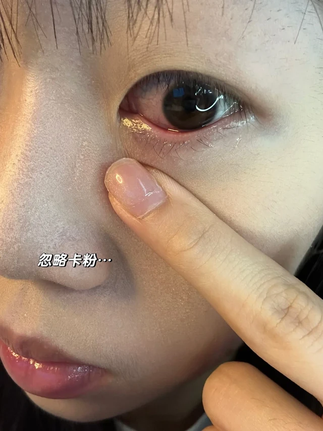 敏感眼就老老实实放弃硅水凝胶吧