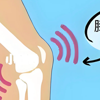 膝盖咔咔响？是正常现象还是健康警报？康复师教你3招自救