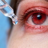 眼药水是‘护眼神器’还是‘视力杀手’？1000+用户观点大碰撞