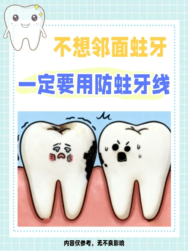 不想牙齿邻面蛀牙！一定要用防蛀牙线！