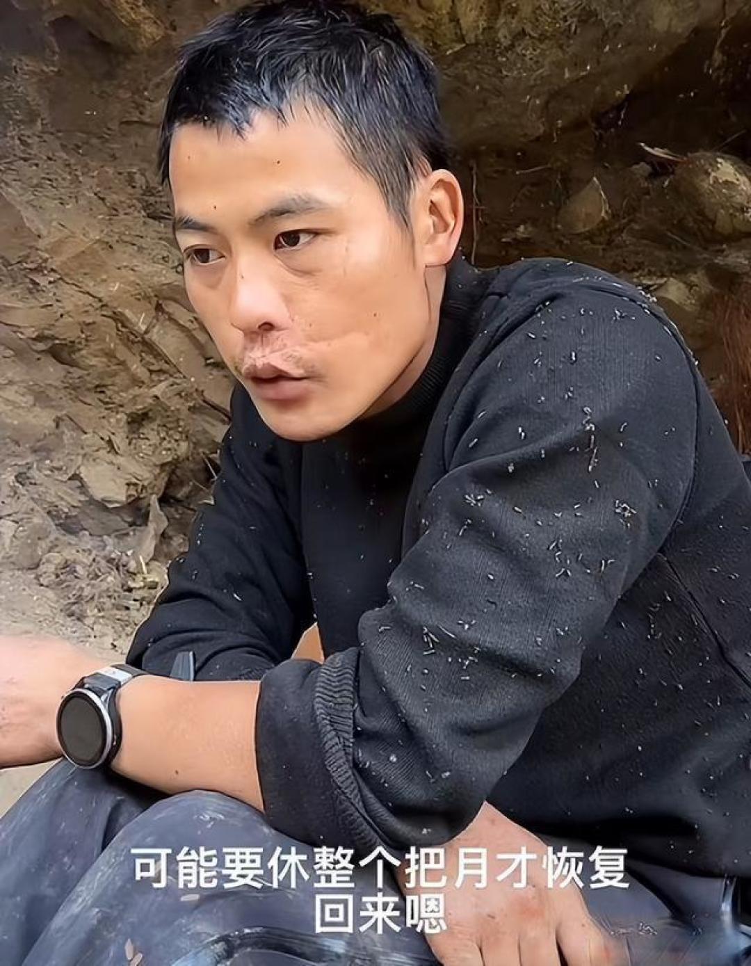 《荒野求生》刀疤哥距2000元奖金只差一天，遗憾退赛！