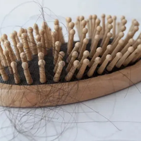 左点激光生发仪Pro：真能生发还是智商税？300+用户真实反馈大PK