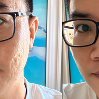重塑净透肌，赫徕氨基酸舒敏特护洁面乳体验