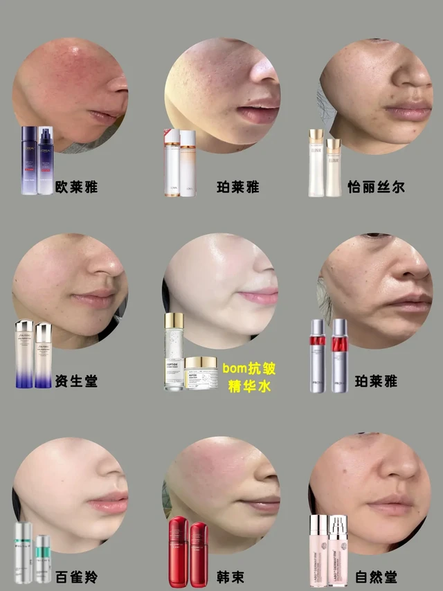 热门水乳真实测评!皱纹/细纹/法令纹/抗老水乳推荐/护肤小技巧/好用的水乳/韩束水乳套装正品旗舰店/珀莱雅双抗水乳/水乳/丸美四抗水乳/HBN早C晚A水乳/水乳推荐/bom抗皱精华水/资生堂悦薇水乳/