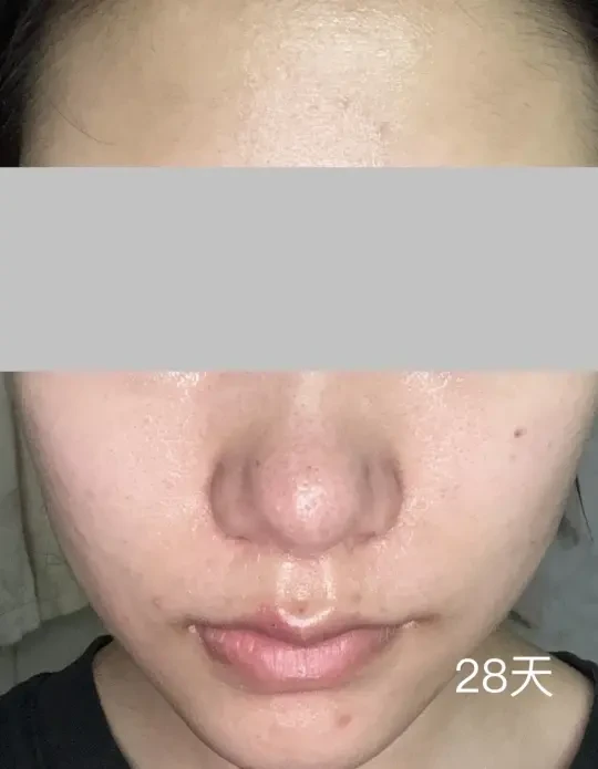 博乐达1-28天使用对比