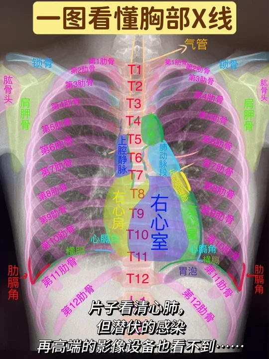 艾滋病日特辑：有些健康“影像”看不到。