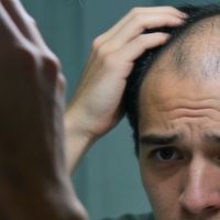 米诺地尔是否真有效？