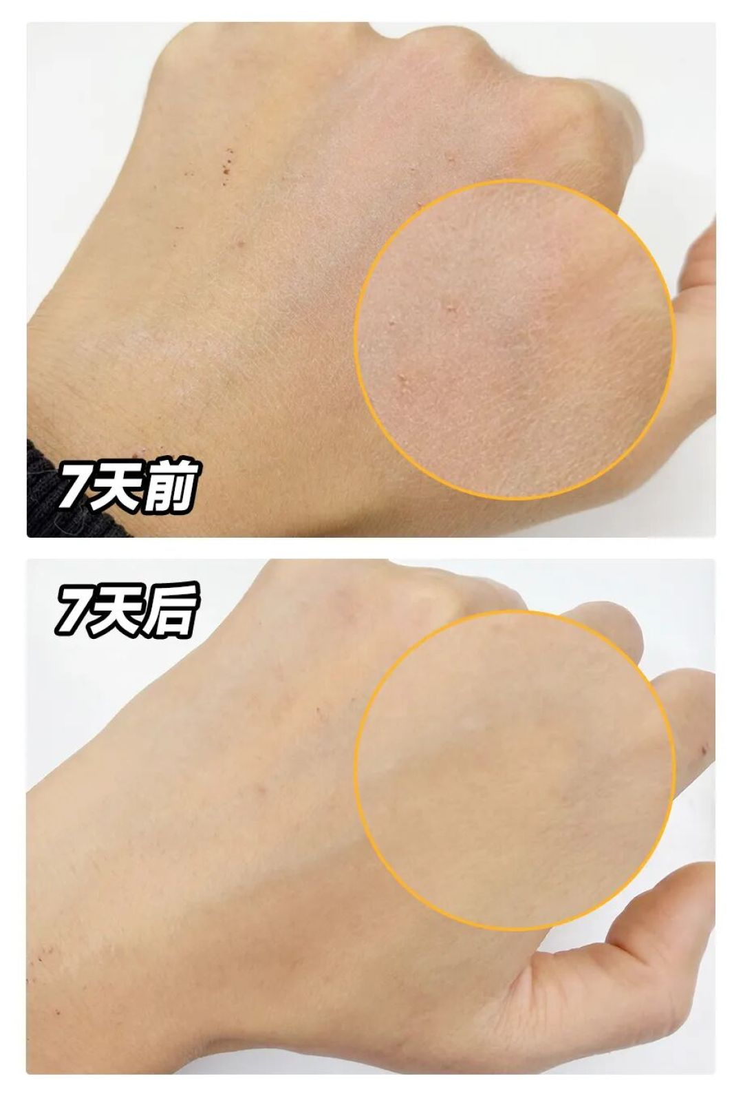 洗完澡 3 分钟后做一件事,皮肤想不好都难!