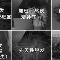 敏感肌脱发怎么选？7款温和修护屏障的防脱洗发水推荐，改善脱发