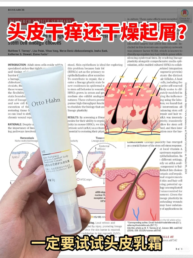 头皮干痒还有干燥起屑？一定要试试头皮乳霜