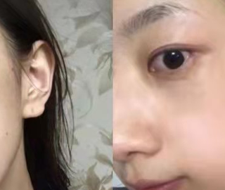 祛斑产品哪个牌子好？国家唯一认证的祛斑产品，最值得入手的产品