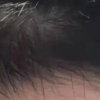 育妍堂草本精华:拯救发际线,告别掉发困扰!