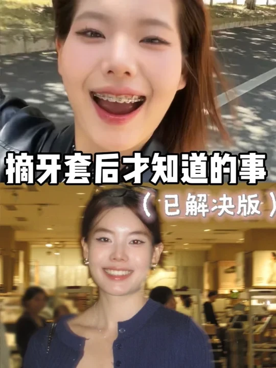 摘牙套后才知道的事