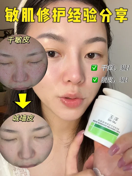 关于我从干敏皮到城墙皮的一些护肤心得……