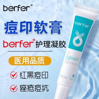 去痘印产品哪款见效快?6款去痘印产品推荐!痘印难题一次性解决