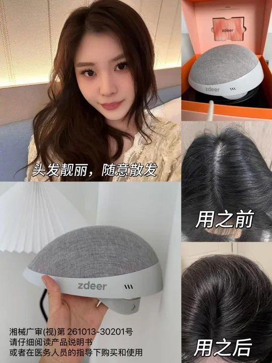 油头掉发可算摆脱了，这生发仪是真的能处！