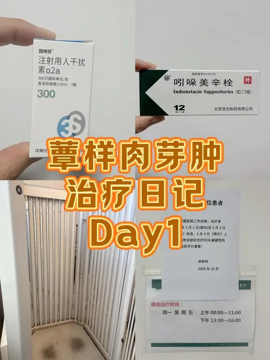蕈样肉芽肿Day1治疗日记
