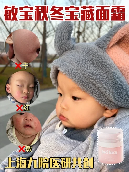 别再让娃 “冻红脸”！敏宝换季护肤这样做💡