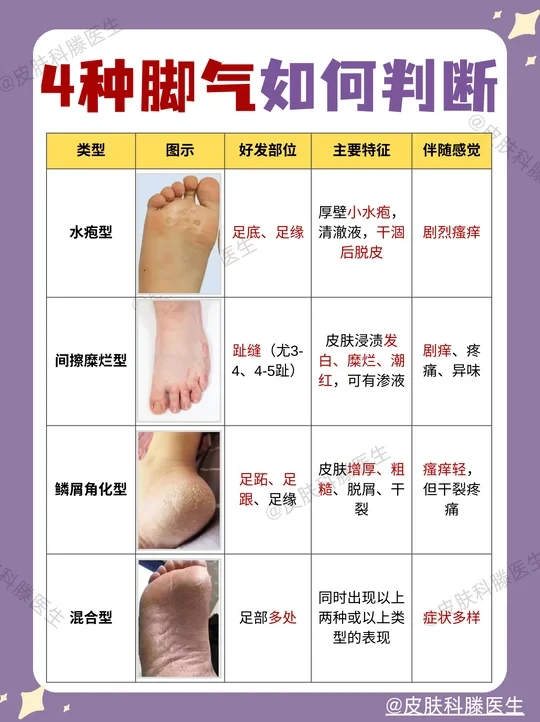 脚臭、脚痒、脱皮？不同脚气症状及用药大全