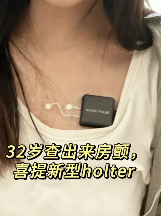 32岁查出来房颤，安排上盒子了