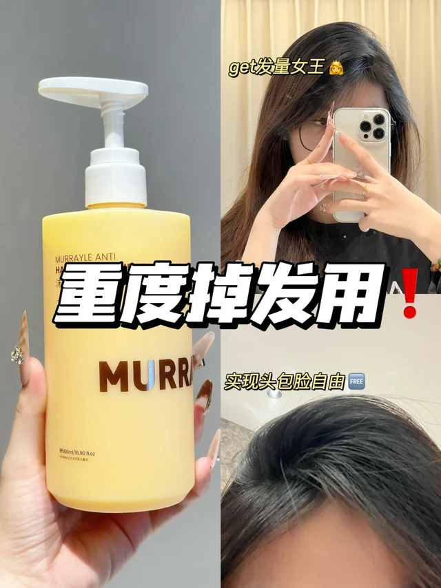 发量暴发！这瓶防脱养发真的超权威。。。
