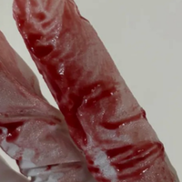 一个过来人治疗痔疮的心得，关于痔疮滴血、疼痛、脱出怎么办？