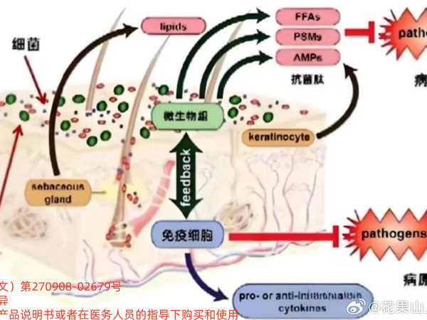 脸上痘痘反反复复怎么办？我是从青春期开始长很大的痘痘，一开始是一个一个地蹦，好了一个就再起一个试了不少涂抹的，甚至内调花了很多钱，效果不大我还干吃过焙过的蝎子，很咸后来上了大学也清洁过，也就前两个痘有