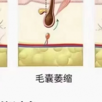 长期防脱不踩雷！2025 六大爆款防脱洗发水推荐国妆特字安全育发