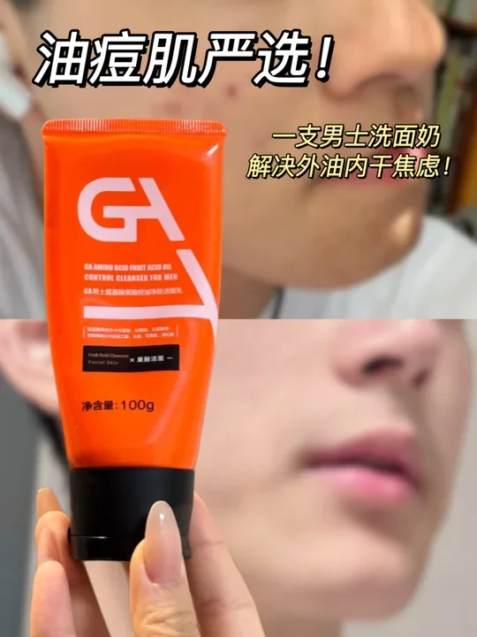 油痘肌严选！一支男士洁面解决外油内干焦虑