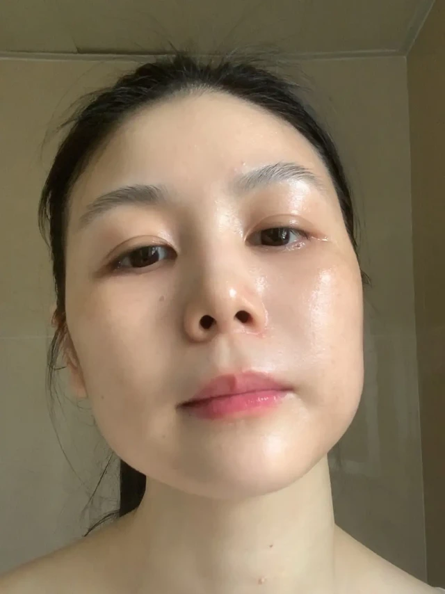 36岁，一张常年只吃鱼油的脸……（脂皮分享）