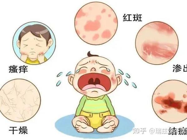 婴儿湿Z科学护理指南｜避开这些坑，用对方法守护宝宝肌肤