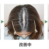 何首乌洗发水能防脱发吗？专家与消费者观点激烈对立